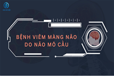 _Bệnh viêm màng não do não mô cầu 